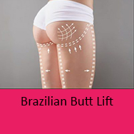 brazilian butt lift